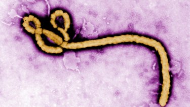 The Ebola virus is one of the scarier viruses.