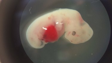 A four-week-old human-pig embryo.