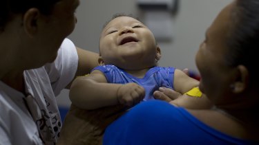 Caio Julio Vasconcelos, who was born with microcephaly, undergoes physical therapy at the Institute for the Blind in Joao Pessoa, Brazil, last month.