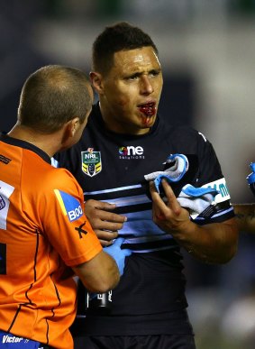 Injury: Sharks forward Anthony Tupou leaves the field with a broken jaw.
