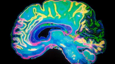 Brain Plaque Researchers Find Alzheimer S Link To A Poor Night S Sleep