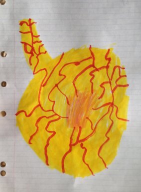 Oscar's drawing of his father's colon cancer, a ''mole in a tummy''. 