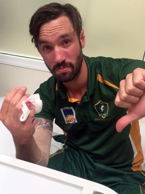 Ouch!: Jono Dean in hospital after dislocating his pinky finger in the regional Twenty20 final.