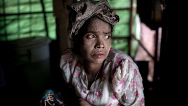 A woman suffering from hunger in a camp in Myanmar.  