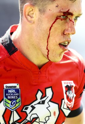 Cameron McInnes bled for the cause at the Auckland Nines.