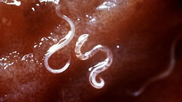 A new trial will start soon with people due to be infected with hookworms to study the impact on coeliac disease.