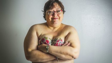 Sherry McGregor, breast cancer survivor has tattoos to cover mastectomy scars. 