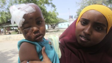A woman holds her child on Monday, who was wounded during a suicide car bomb attack at Jazeera hotel in Mogadishu.