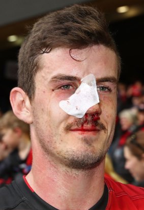 Bumped: Essendon's Michael Hartley leaves the field after being injured.