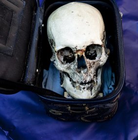 The mystery skull at the centre of the investigation, given by Tom Baxter to the Victorian Institute of Forensic Medicine on November 11, 2009. 