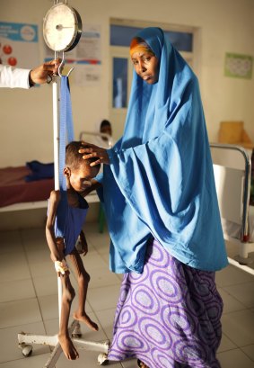 An emaciated Somali boy is weighed next to his distraught mother.
