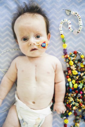 Three-month-old Charlie Clode has a complex heart condition. Each 300 bead represents a medical incident, but the smileys show "good days".