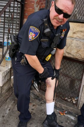 A police officer shows the bruises on his leg, after violence erupted in Baltimore.