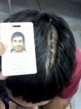 Machete cuts to the scalp: Another injured detainee.