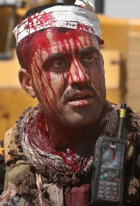 An injured Iraqi officer waits for treatment on the front line during clashes with Islamic State extremists in Tikrit.