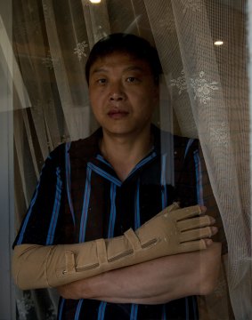 Injured: Chinese migrant Andy Zhang, whose arm was mangled in a work accident.