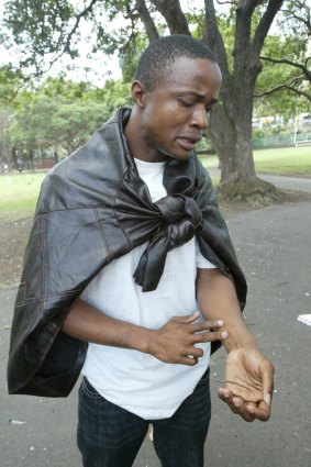 Lamin Tucker in 2006, showing injuries he sustained back in Sierra Leone.