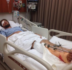 Queenslander Peter Maitland recovering from his accident in Cambodia.
