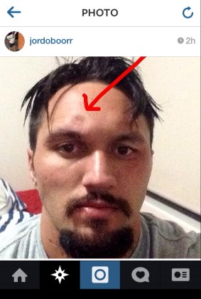 Canberra Raiders fullback Jordan Rapana posted a photo of his fractured skull on Instagram. 