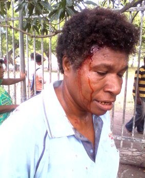 Esther Was bleeds from a head wound suffered during the student protest in Port Moresby on Wednesday.