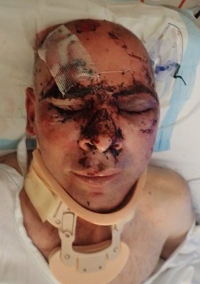 One of the Orelia assault victims in hospital.