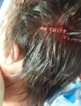International student Alex suffered a nasty head injury in an attack in Innaloo.
