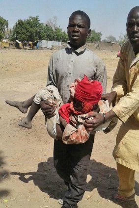 A man carries an injured child following the air strike on a camp for displaced people in Rann, Nigeria on Tuesday, January 17.