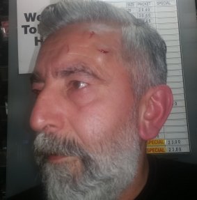 Senol Kocabiyik was hit in the head with Eclipse mints tins. 