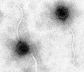 Bacteriophages, discovered a century ago, may prove vital in a time of bacterial resistance.