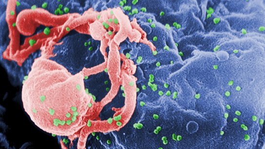 A scanning electron micrograph of multiple round bumps of the HIV-1 virus on a cell surface.