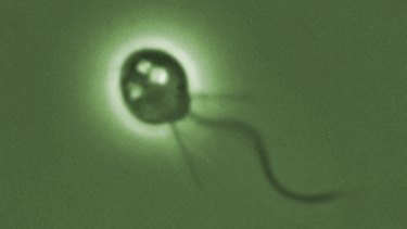 It's thanks to choanoflagellates, like this one, that the mutation discovery was made.