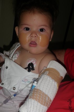 Katelyn Lambert receives treatment as a baby.
