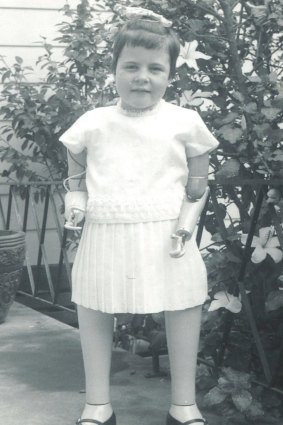 Lyn Rowe as a child with prosthetic arms and legs. 