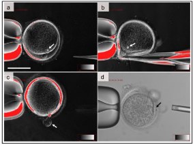 The therapeutic cloning of an adult cell.