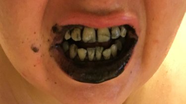 I Brushed My Teeth With Charcoal For Six Weeks Because A Facebook