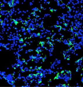 Human cells in pig embryos.