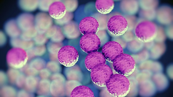 An automated imaging and analysis system which can ''read'' microbiology culture plates faster than a human is behind a sharp jump in the share price of LBT Innovations.