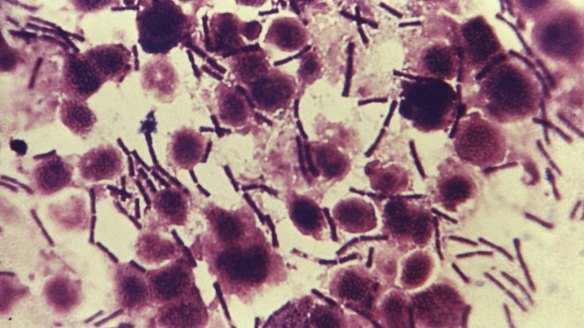 Investigation launched into US shipment of anthrax to Australia