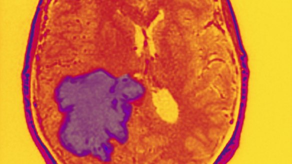 Rare earth metals, like gadolinium, were a major feature of the share race this week.