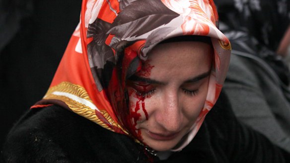 A woman bleeds from an injury after riot police disperse supporters of the Zaman newspaper.
