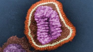 A negative-stained transmission electron microscopic image shows the ultrastructural details of an influenza virus particle.
