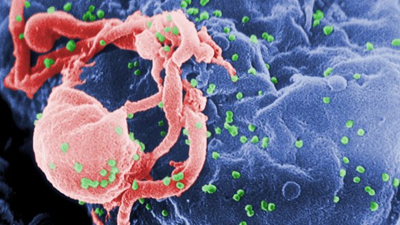 A scanning electron micrograph of multiple round bumps of the HIV-1 virus on a cell surface.
