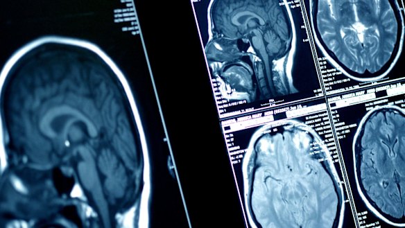 Working with cancer could have benefits.