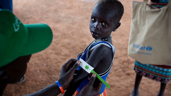 A boy has his arm measured to see if he is suffering from malnutrition.