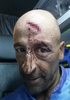 Skipper Oliver Galea received a deep gash on his forehead and others were knocked unconscious after the whale hit the charter boat.