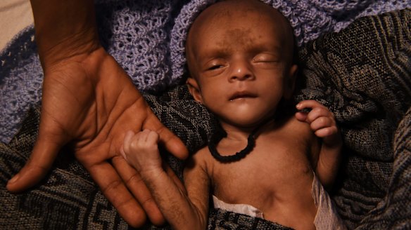 Ifran, a tiny malnourished baby, his heart struggling with every breath, lies on a stretcher in a Red Cross field hospital tent in south-eastern Bangladesh. 