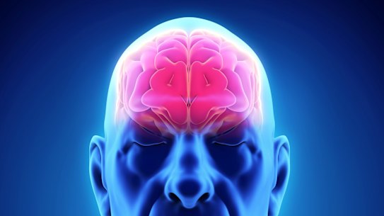 Health authorities fear the Strokecheck test does more harm than good.