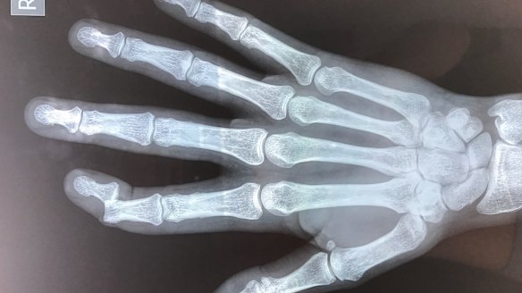 Health insurers have hiked their premiums by a cumulative 54 per cent over the past eight years.