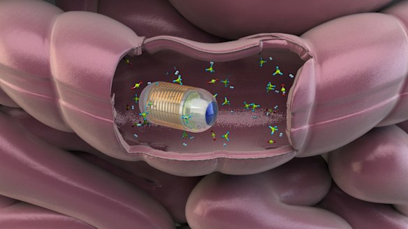 Gut feeling: the swallowable gut sensor that could replace a colonoscopy
