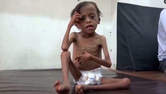 United Nations officials say Yemen will face the world's largest famine in decades if the Saudi-led coalition refuses to lift its blockade on deliveries of aid.